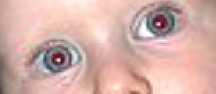 Príklad na filter Red Eye Removal (Odstránenie efektu červených očí)